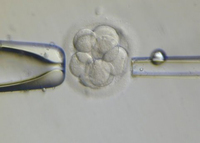 Embarazos múltiples por reproducción asistida