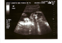 140.000 euros de sanción por no detectar malformaciones en un feto