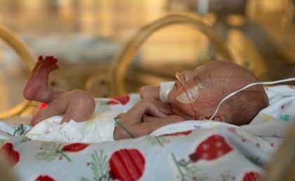 Los bebés muy prematuros son más tímidos e inhibidos, según estudios