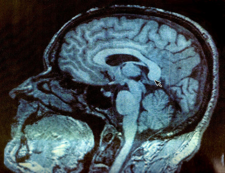 Paul Allen dona 300 millones de dólares a la investigación del cerebro