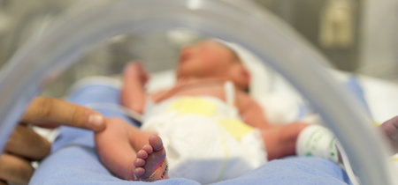 Cada año nacen en el mundo 15 millones de bebés prematuros