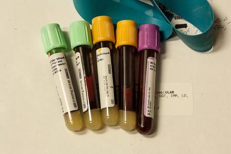 Análisis de sangre en el embarazo: para qué se realizan
