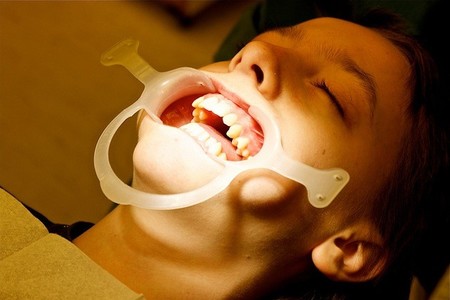 Casi la mitad de los niños españoles no acude al dentista para realizar revisiones preventivas