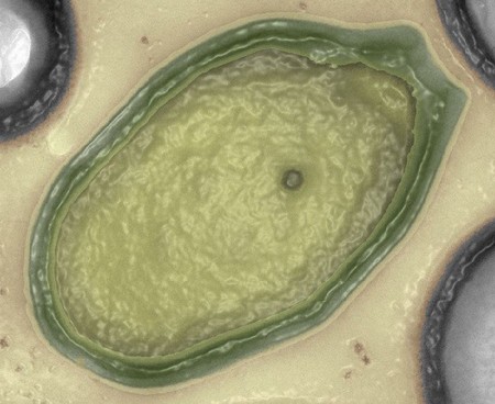 Virus gigantes plantean preguntas acerca de la vida
