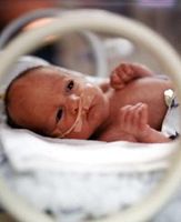 Siete síntomas para detectar complicaciones severas en el recién nacido