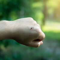 Los últimos mosquitos del año son los peores. Por suerte, su kryptonita para frenar las picaduras es una canción de Skrillex 