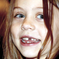 La bonita carta de la directora del colegio al Ratoncito Pérez tras perder un niño un diente en el patio 