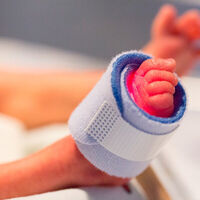 Cada año nacen en España entre 1.000 y 1.100 bebés prematuros antes de la semana 28 