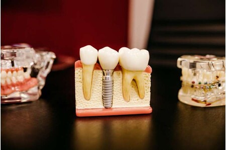 La IA ayuda a identificar a las personas que están en riesgo de pérdida de dientes sin la necesidad de un examen dental