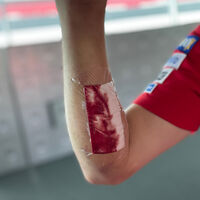 Qué es el síndrome compartimental, la lesión que persigue a los pilotos de MotoGP e hizo perder a Fabio Quartararo  en Jerez