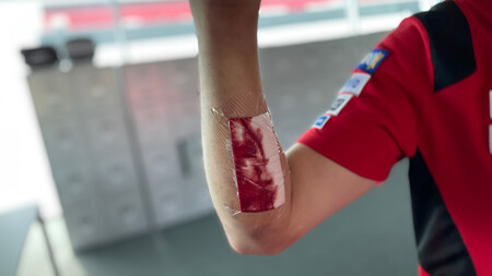 Qué es el síndrome compartimental, la lesión que persigue a los pilotos de MotoGP e hizo perder a Fabio Quartararo  en Jerez