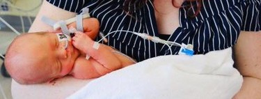 Un bebé con espina bífida es operado a las 27 semanas de embarazo en el útero materno, mediante la cirugía de 'ojo de cerradura'