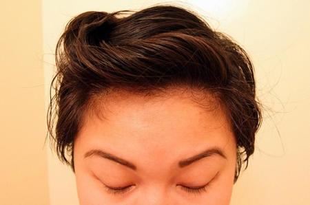 ¿Qué hacer si tengo piojos durante la lactancia?