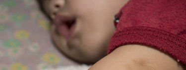 Picaduras de insectos en bebés y niños, ¿qué hacer y cómo prevenirlas?