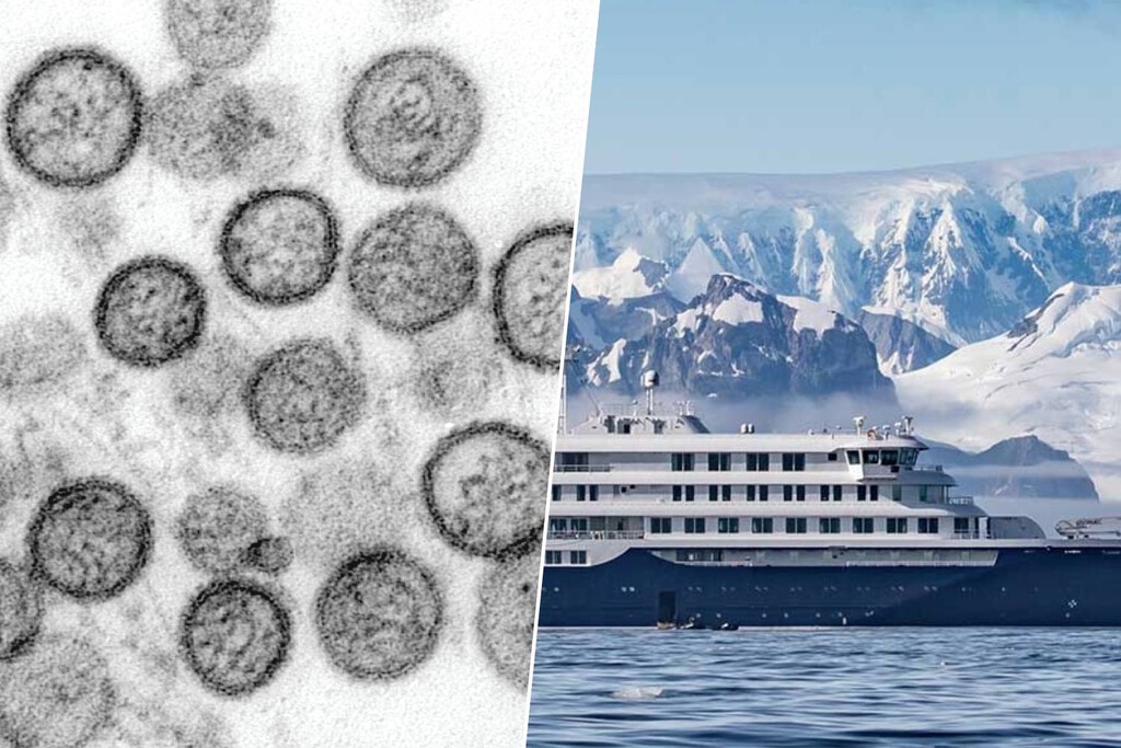 La variante Andes: por qué al principio todos asumíamos que era zoonosis y ahora ya hablamos de contagio entre humanos