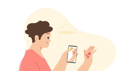 Google podrá detectar enfermedades en la piel a través de la cámara del móvil