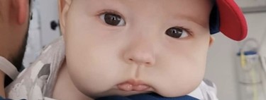 Nico solo tiene seis meses y necesita con urgencia un trasplante de médula para combatir la leucemia