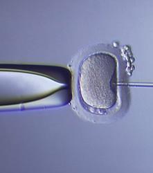 Años de espera para una fecundación in vitro en la sanidad pública