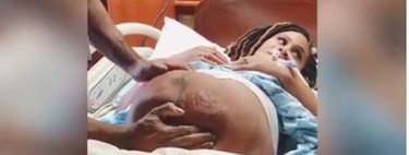 Impresionante vídeo de una versión cefálica externa para dar vuelta al bebé que viene de nalgas