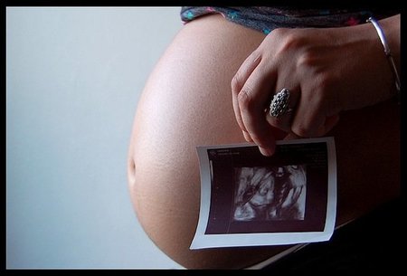 Retraso del crecimiento intrauterino