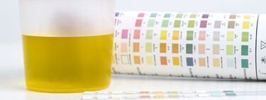 Estamos desperdiciando un recurso inagotable: la orina. Y podría solucionar los problemas de fertilizantes y aguas residuales 