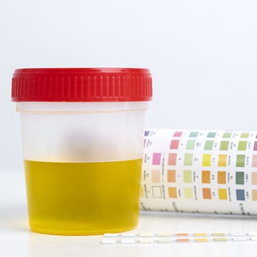 Estamos desperdiciando un recurso inagotable: la orina. Y podría solucionar los problemas de fertilizantes y aguas residuales 