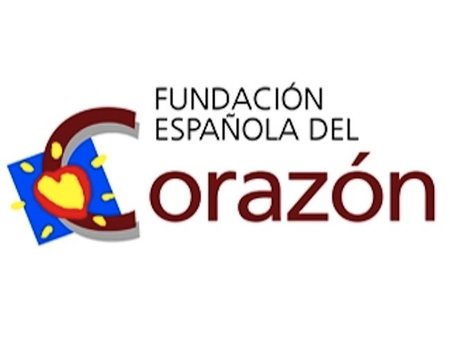 ¿Por qué mueren más mujeres que hombres por infarto?