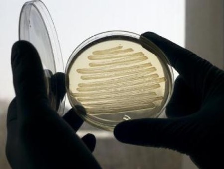 Bacterias para la producción de diésel