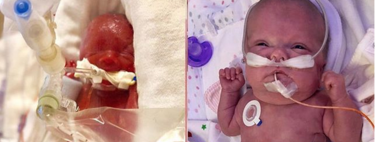 La madre de una bebé prematura comparte el increíble cambio físico de su hija tres meses después de haber nacido
