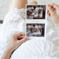 Polémica ley de aborto en Eslovaquia: obliga a la mujer que quiere abortar a ver una imagen del feto y escuchar su latido