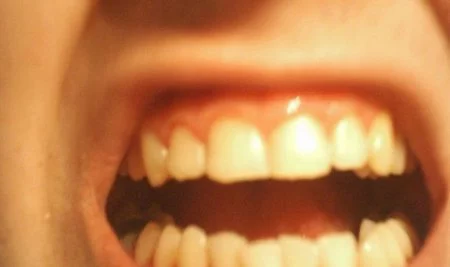 Es preferible ir una vez al año al dentista que lamentar después