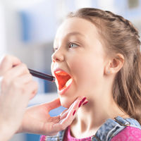 Amigdalitis vírica y bacteriana: cuáles son los síntomas y cómo se tratan las placas en la garganta