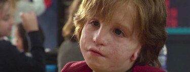 Síndrome de Treacher Collins: todo sobre la enfermedad que hizo visible la película 'Wonder'     