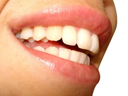 Consejos para limpiar bien nuestros dientes
