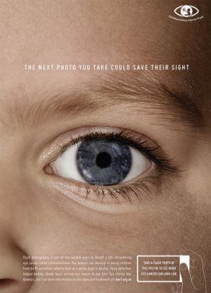 Una simple comprobación con un flash sirve para detectar el retinoblastoma en los niños