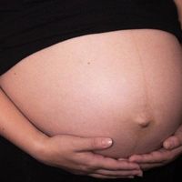 Tipos de contracciones