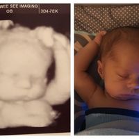 La divertida foto de un bebé durmiendo en la misma posición que lo hacía en el útero materno