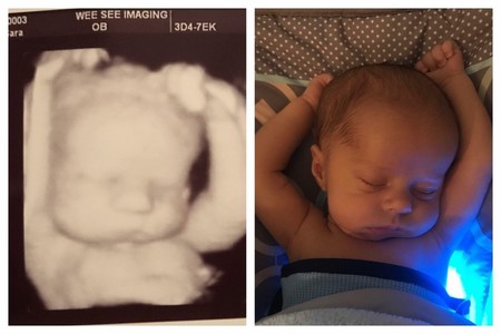 La divertida foto de un bebé durmiendo en la misma posición que lo hacía en el útero materno