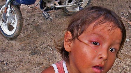 Déficit de vitamina B en bebés y niños