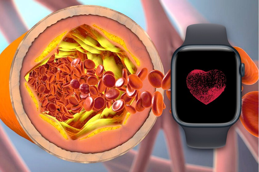 ¿Cuáles son los valores normales de colesterol? Así puedes registrar su evolución con tu Apple Watch