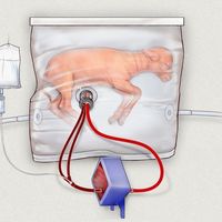 Crean un útero artificial para los grandes prematuros (pero la madre sigue siendo lo primero)