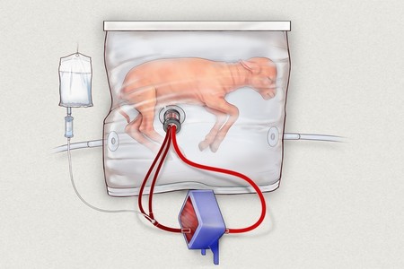 Crean un útero artificial para los grandes prematuros (pero la madre sigue siendo lo primero)
