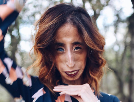 Lizzie Velasquez es una mujer, no un meme. Y se lo ha dejado claro a todos los que practican el bullying. 