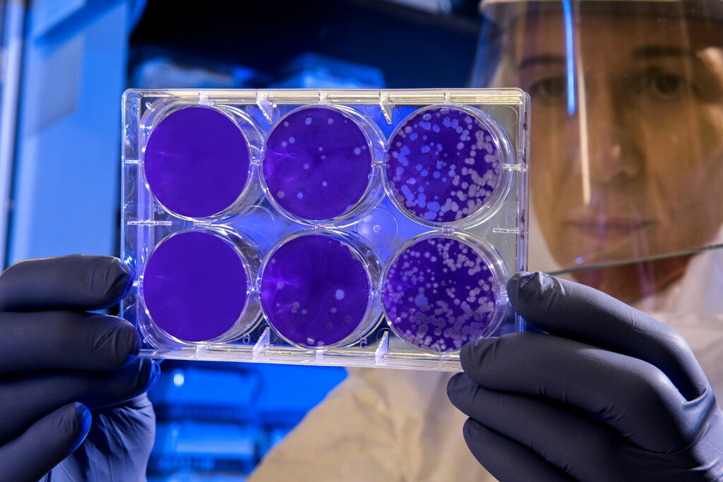 Hemos descubierto el 'botón' que usan las bacterias para escapar de los virus: es la clave para acabar con las superbacterias 