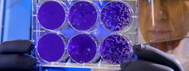 Las bacterias tienen un 'plan de escape' para sobrevivir a los virus que las matan, y es clave para vencer a las superbacterias