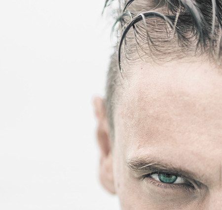 Tricopigmetacion Caida Cabello