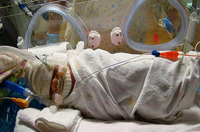 Envolver a los prematuros alivia su dolor