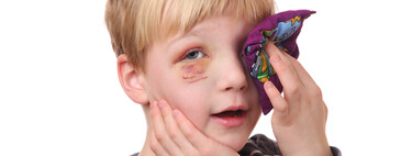 Golpes y lesiones dentro y fuera del ojo: cómo actuar ante un traumatismo ocular en niños