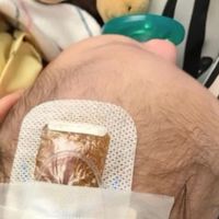 Comparte la historia de su sobrina, enferma de Haemophilus influenzae B, para concienciar de la importancia de vacunar 