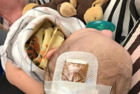 Comparte la historia de su sobrina, enferma de Haemophilus influenzae B, para concienciar de la importancia de vacunar
